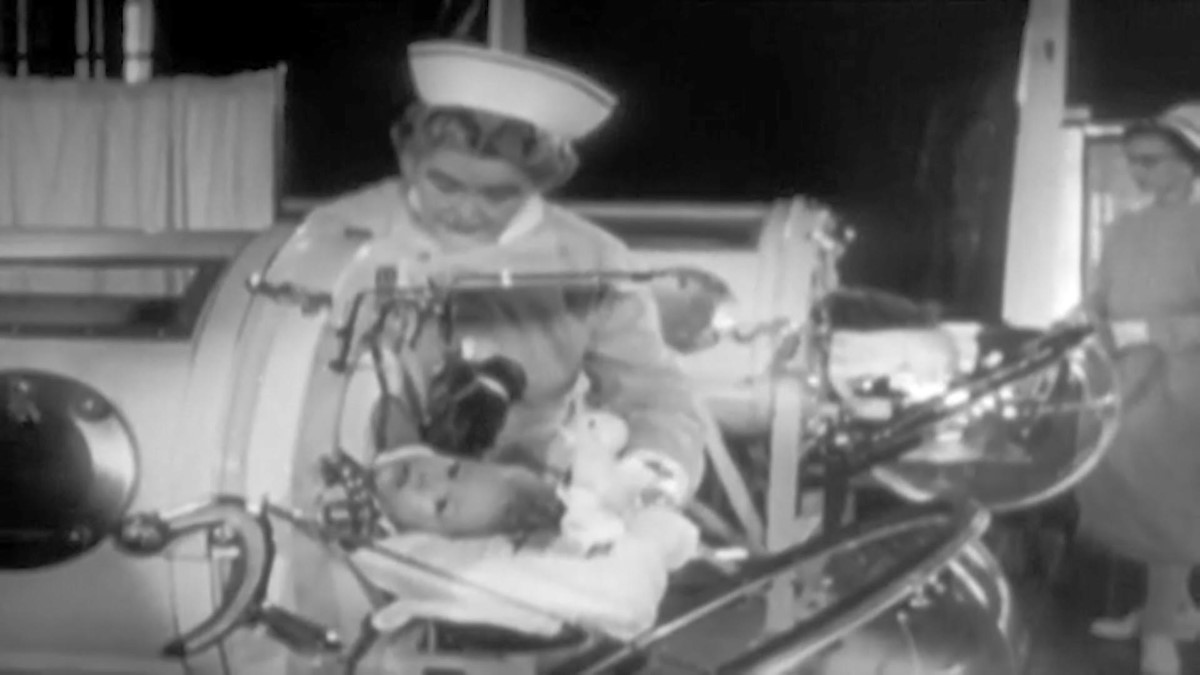 A young girl with polio lies in an iron lung with a nurse looking over her